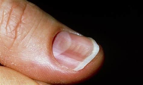 十个手指甲,一个月牙都没有,代表身体不健康?这才是科学的解释|指甲|月牙|身体_新浪新闻