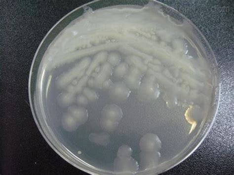 一种硫酸多黏菌素B生产菌株、硫酸多粘菌素B的制备方法及应用与流程