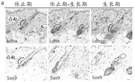 学习美发基础知识-毛发的生长认识,,导航培训学校