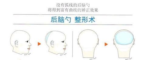 后脑勺详细部位图图片