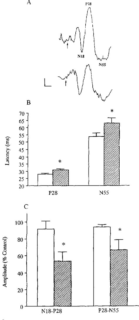Figure 3 from Serotoninergic depression of auditory evoked responses ...