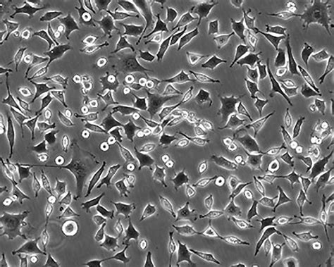 RF/6A细胞ATCC CRL-1780细胞 RF6A猴脉络膜-视网膜（皮下）细胞株购买价格、培养基、培养条件、细胞图片、特征等基本信息_生物风