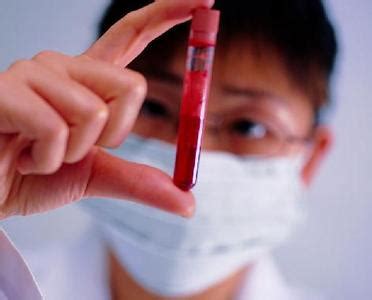 溶血标本对检验结果的影响的原因分析及注意事项_红细胞