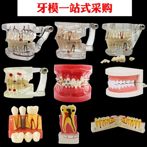 亚洲人对牙齿的审美标准是什么样的？ - 知乎