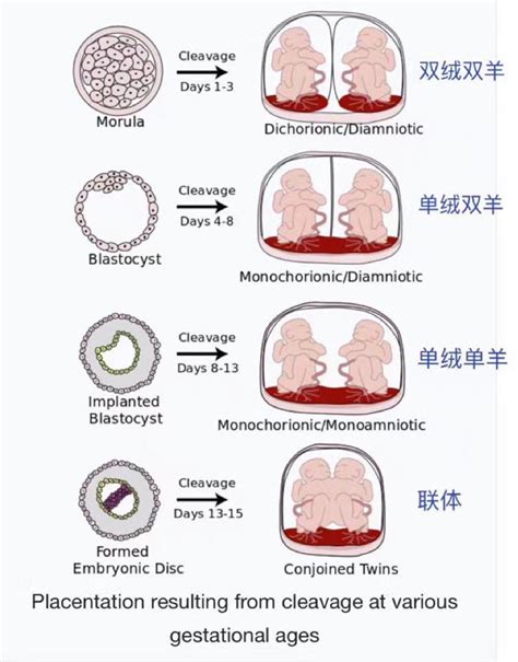 双胎绒毛膜性和卵子性的区别 - 微医（挂号网）