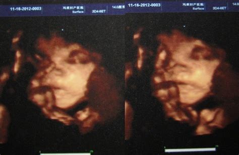 能看出是男孩还是女孩吗？也请帮忙分析下其他的信息 27周孕妇三维彩超照片 - 百度宝宝知道