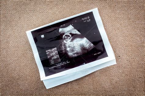 超声波对未出生婴儿高清图片下载-正版图片505239205-摄图网