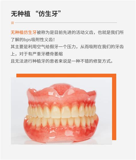 市口腔医院李敢：补牙首选种植牙，高科技仿生媲美真牙 - 全程导医网