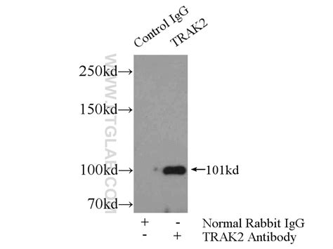 TRAK2 Antibody 13770-1-AP | Proteintech