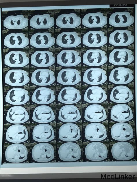 关于空军总医院