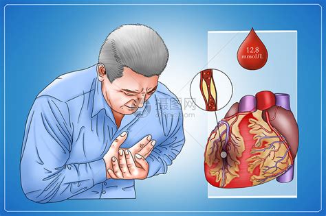 糖尿病并发症心脏病医疗插画插画图片下载-正版图片401801861-摄图网