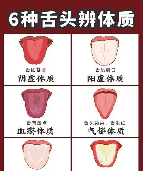 中医教你怎么通过舌头辨别6种体质,来对照一下你属于哪种体质?|舌头|体质|中医_新浪新闻