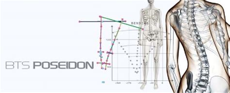 Spine 3D脊柱扫描-上海礼昆医疗器械有限公司