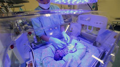 波兰一名孕妇死亡55天后诞下男婴 - 2016年4月20日, 俄罗斯卫星通讯社