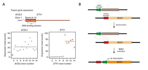 EML4-ALK融合基因突变的前世今生-肺癌康复圈-觅健