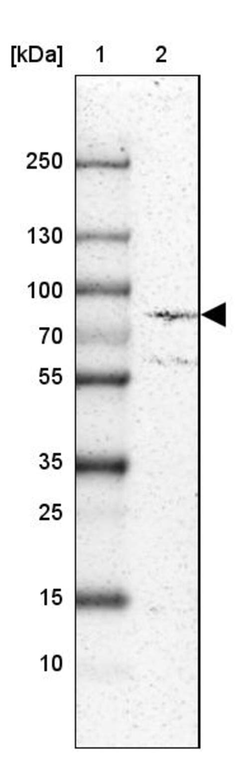 Anti-ECE1 antibody produced in rabbit