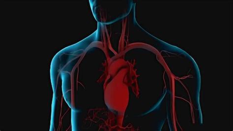 医学3D动画演示：动脉粥样硬化与外周血管疾病
