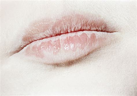 嘴唇这个颜色竟是心脏病前兆，你的唇色健康吗_凤凰网健康_凤凰网