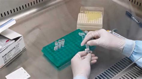 隐球菌抗原检测试剂盒(胶体金法)