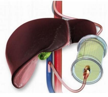 突破性创新设备有效延长供体肝脏保存时间至24小时