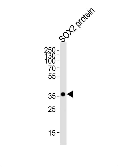 SOX2 Antibody - Purified Mouse Monoclonal Antibody (Mab) IF, WB, IHC-P ...