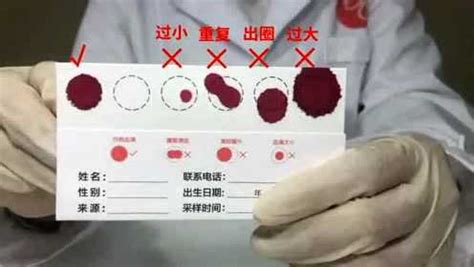 一位血液科医生自述：这些年，造血干细胞移植工作让我看到了希望-北京市脐带血造血干细胞库