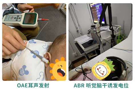 筛查型听力计-听力计-广州甘峰听力设备有限公司