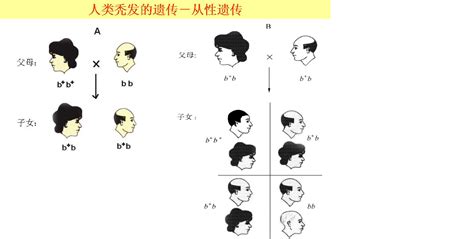 秃顶遗传规律图,秃顶的,秃顶基因传方式图(第9页)_大山谷图库