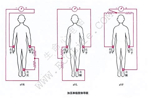 心电图连接示意图图片