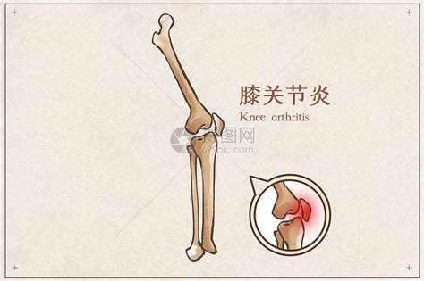 关节示意图图片