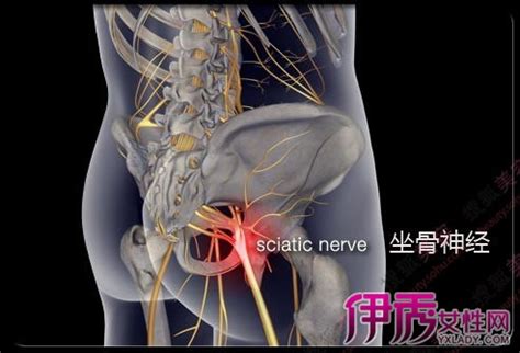 【大腿根部疼痛】【图】大腿根部疼痛是怎么回事 六步教你缓解疼痛(2)_伊秀健康|yxlady.com