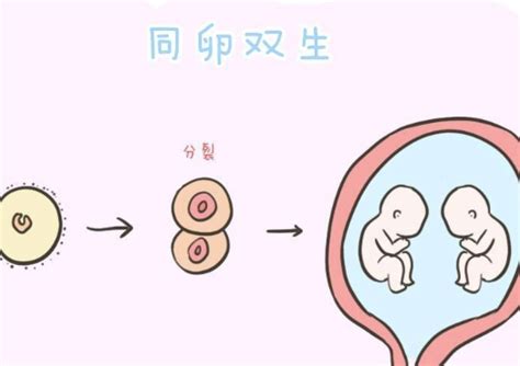 多胎妊娠 - 知乎