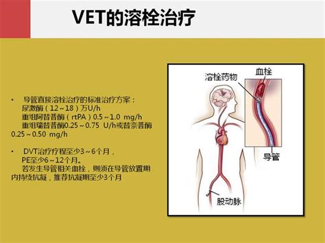 肿瘤患者与静脉血栓栓塞症（VTE）