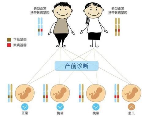 基因检测VS常见的染色体遗传病有哪些-香港验血无创DNA预约机构-Zentrogene基因检测中心【官网】