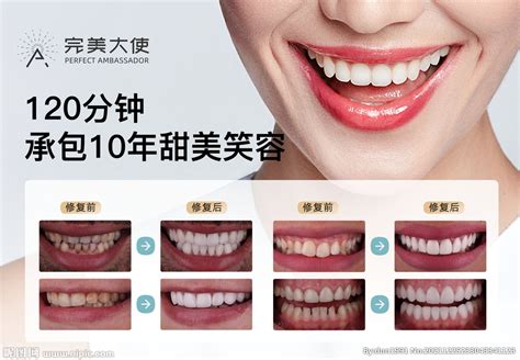 美牙广告图片-美牙广告素材免费下载-包图网
