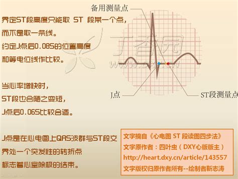 三、从双极肢导联中QRS波的波型确定心电轴-心血管-医学