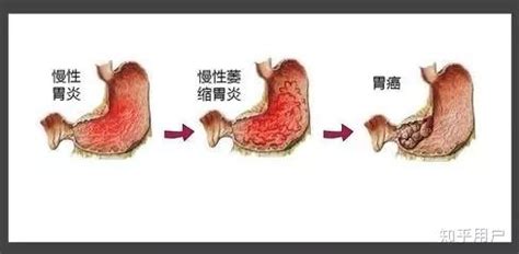 （消化生理学系列）生理学05-3：消化生理-胃的运动与消化 - 知乎