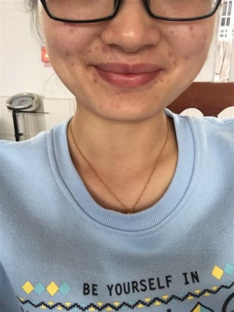 腾蛇入口面相图片