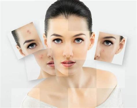 敏感肌肤的特征，该怎么护理，这四个建议，对你很有帮助！_伊秀美容网|yxlady.com