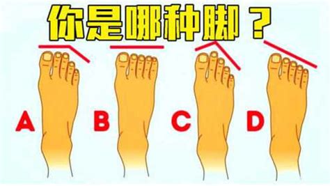 依据脚趾长度，可分辨埃及脚、罗马脚和希腊脚，知道你是哪种吗？