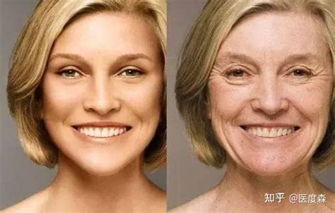 皮肤自然衰老的真相——如何预防皮肤氧化 - 知乎