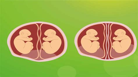 同卵双胞胎形成原因揭秘，发育过程图带你弄清其中原理_宝宝之家