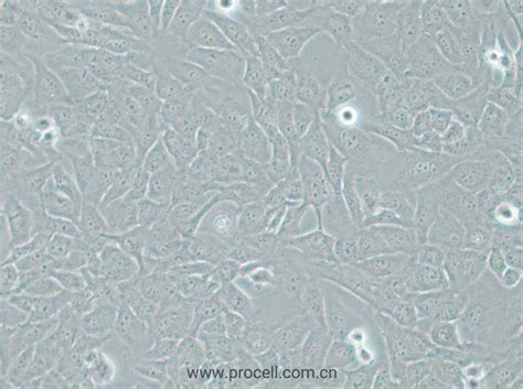 AC16 (人心肌细胞) (STR鉴定正确) - 武汉普诺赛生命科技有限公司 - 您身边的细胞专家【官方网站】