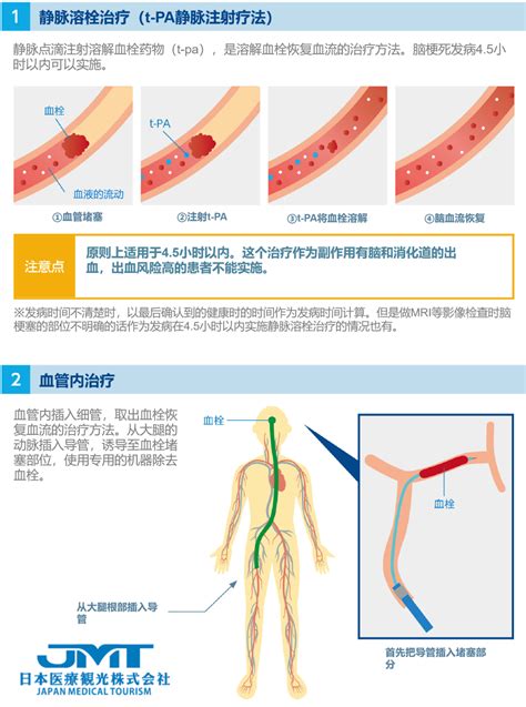 分子时代自体造血干细胞移植在弥漫大B细胞淋巴瘤非特指型治疗中的地位