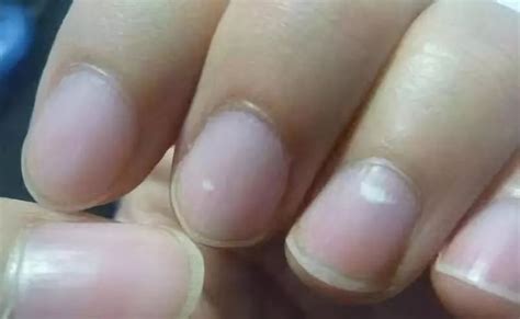 【脚指甲变白是怎么回事】【图】脚指甲变白是怎么回事 揭晓指甲泛白的主要病因(2)_伊秀健康|yxlady.com