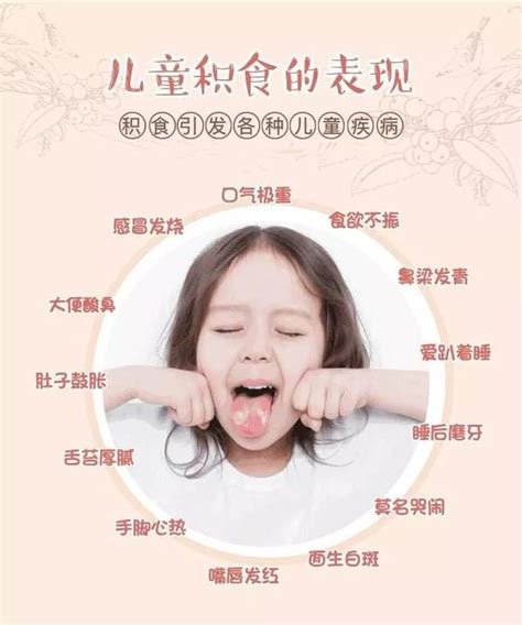 小儿积食舌苔图片