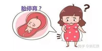 胎停育有什么征兆？ - 知乎