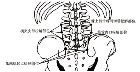 腰椎l3-s1位置,l3s1椎间盘位置图,腰椎l3-s1(第2页)_大山谷图库