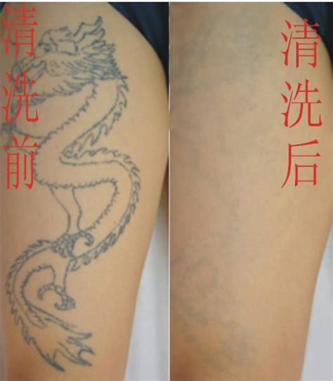 6个洗纹身后的效果图片-上海纹彩刺青