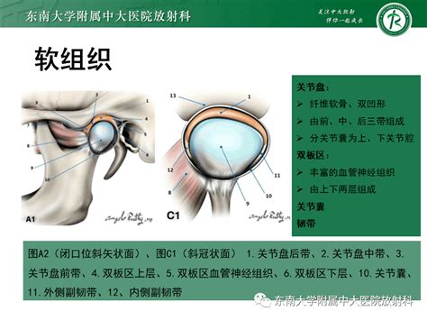 颞下颌关节解剖图图片 颞下颌关节解剖图图片